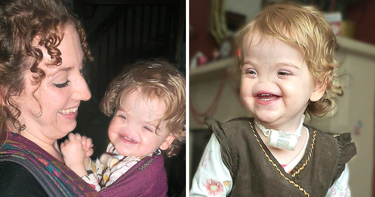 She was born without a nose, was nicknamed “Voldemort” and became an example of overcoming